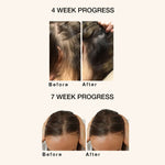 Thumbnail for Skog Super Hair Repair