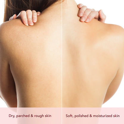 Botanic Hearth Moisture Bloom Body Oil - Distacart