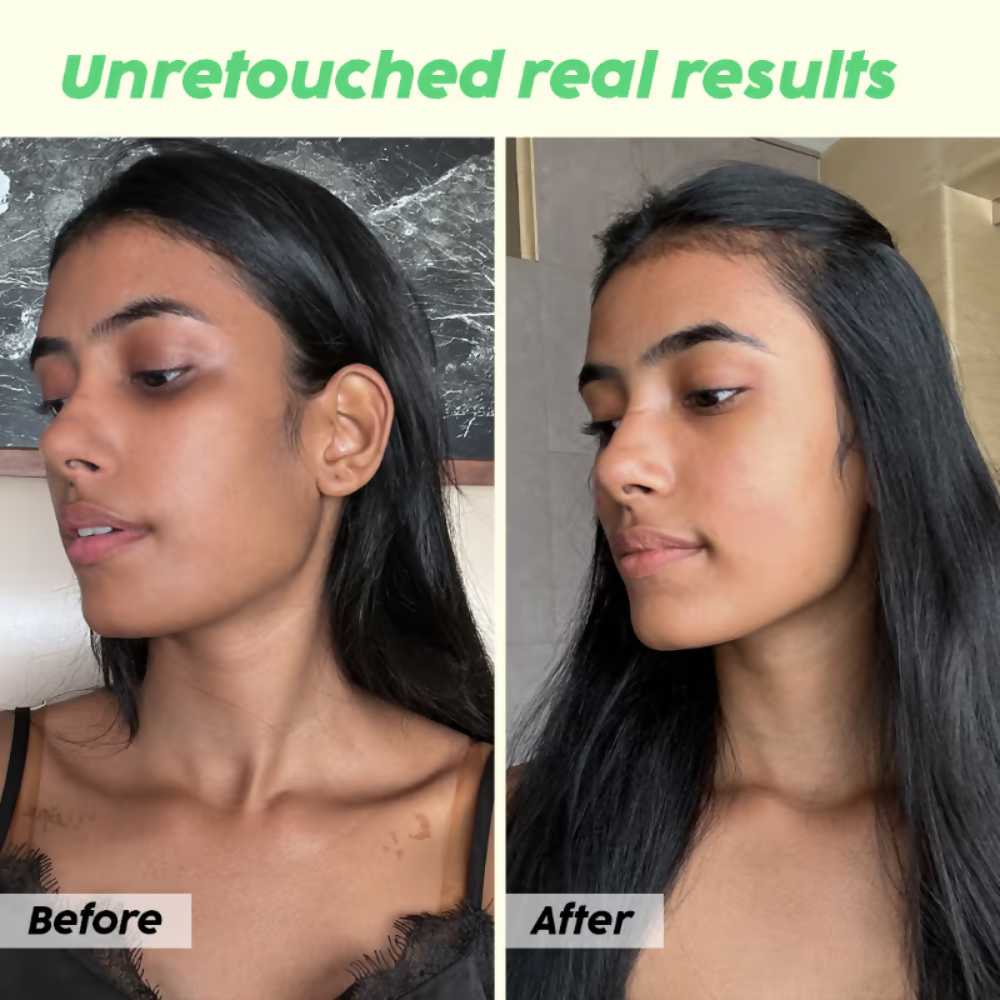 PLIX The Plant Fix Guava Glow Regime Combo - Distacart