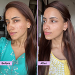 Thumbnail for PLIX The Plant Fix Jamun Active Acne Regime - Cleanser, Acne Mark Serum, Moisturizer & Body Wash For Women & Men - Distacart