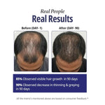 Thumbnail for Reginald Men Athena- All in one Hair Serum - Distacart