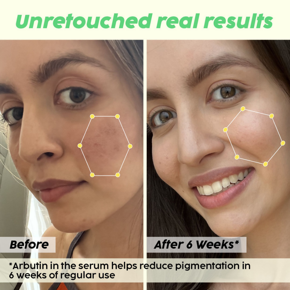 PLIX The Plant Fix Underarm Depigmentation Serum Spray & 2% Alpha Arbutin Face Serum - Distacart