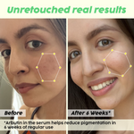 Thumbnail for PLIX The Plant Fix Underarm Depigmentation Serum Spray & 2% Alpha Arbutin Face Serum - Distacart