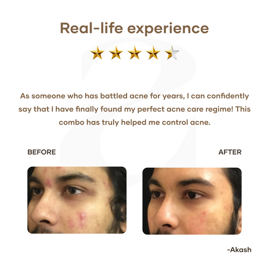 Mars By GHC Mars Ultimate Acne Care Regime Combo - Distacart