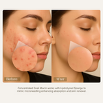 Thumbnail for Seoulskin Snail Mucin Micro-needling Serum 7500 PPM - Distacart