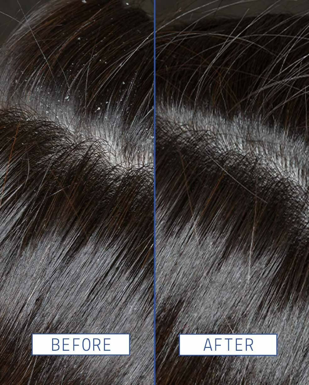 Aavrani Scalp Rescue Serum - Distacart