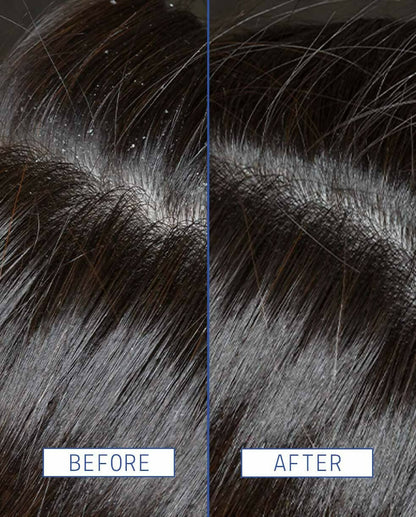 Aavrani Scalp Rescue Serum - Distacart