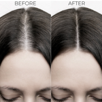Thumbnail for Brillare Hair Fall Control Kit - Dista