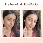 Thumbnail for Alps Goodness Grapeseed De-Tan Facial Kit - Distacart