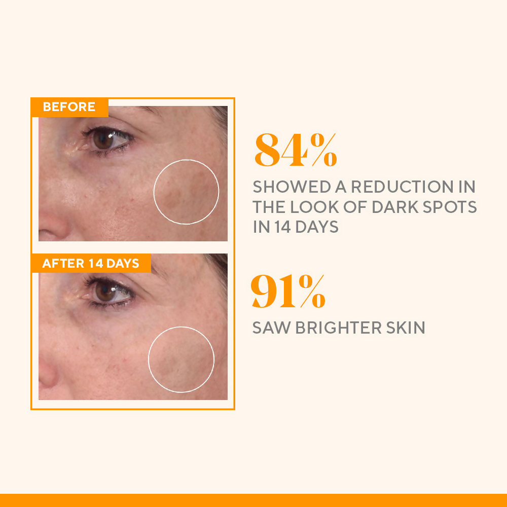 Murad Rapid Dark Spot Correcting Serum - Distacart