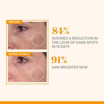 Murad Rapid Dark Spot Correcting Serum - Distacart