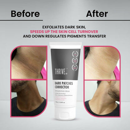 Thriveco Dark Patches Corrector Cream - Distacart