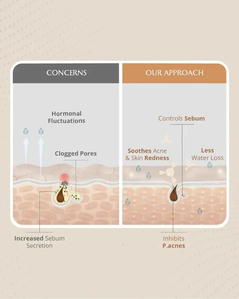 AreoVeda Moisturising Spray Lotion - Distacart