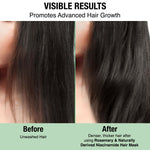 Thumbnail for Nykaa Naturals Advanced Hair Growth Hair Mask With Rosemary & Naturally Derived Niacinamide - Distacart