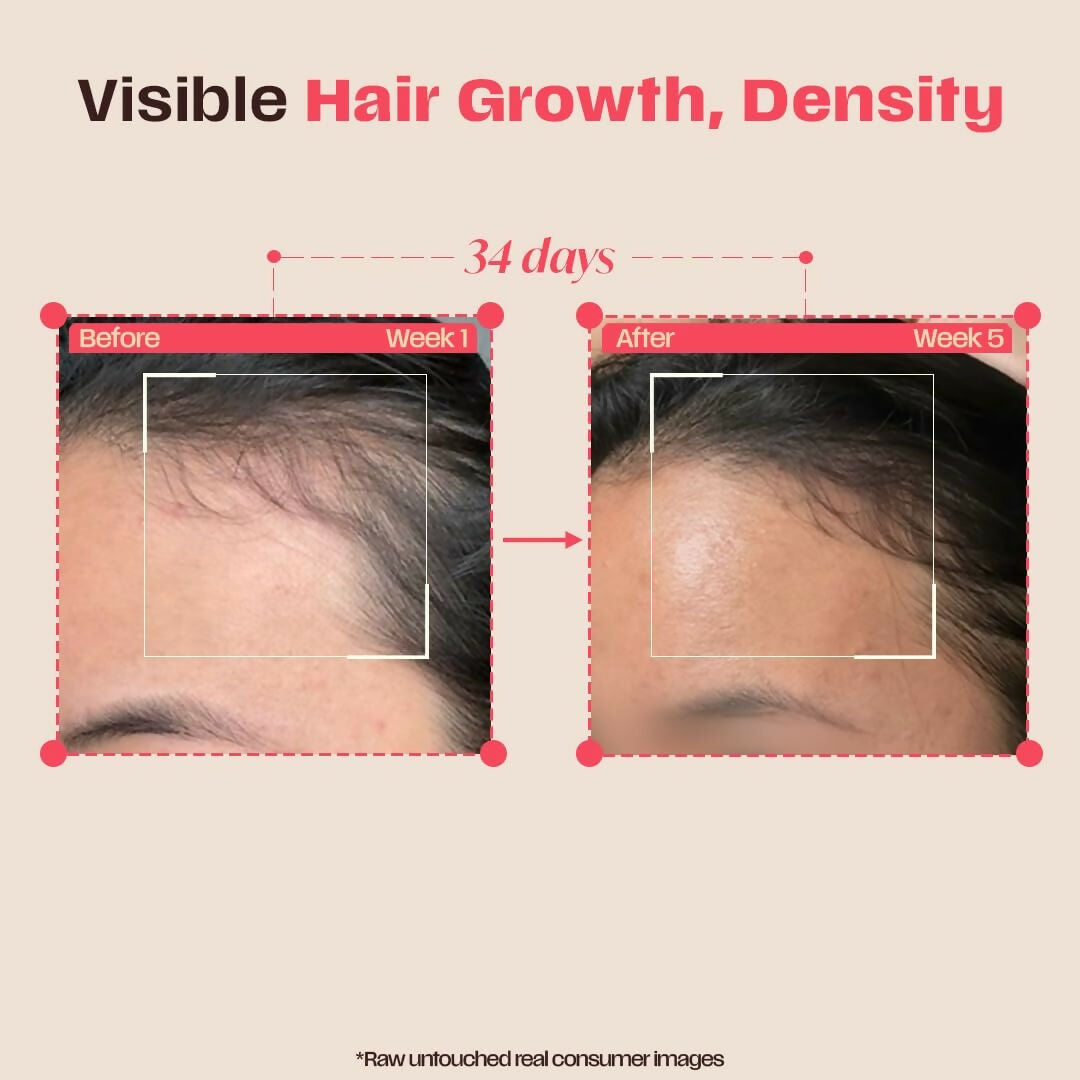 Days Ahead Leave-in Hair Growth Ampoule Serum (Roll on) - Dista