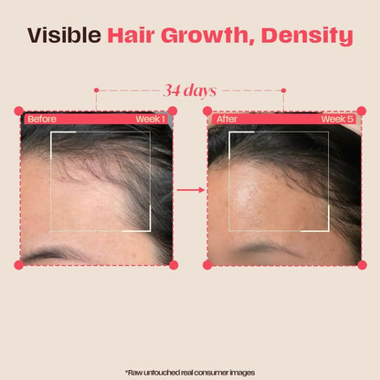 Days Ahead Leave-in Hair Growth Ampoule Serum (Roll on) - Dista