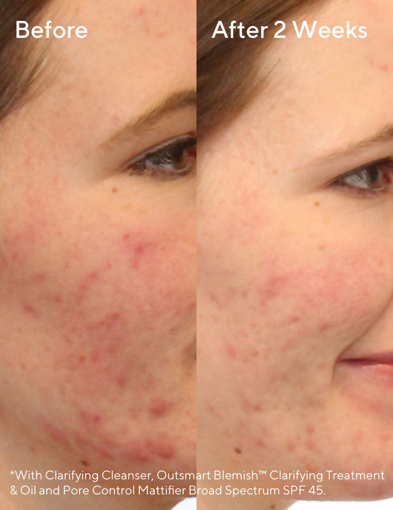 Murad Blemish Control Clarifying Cleanser - Distacart