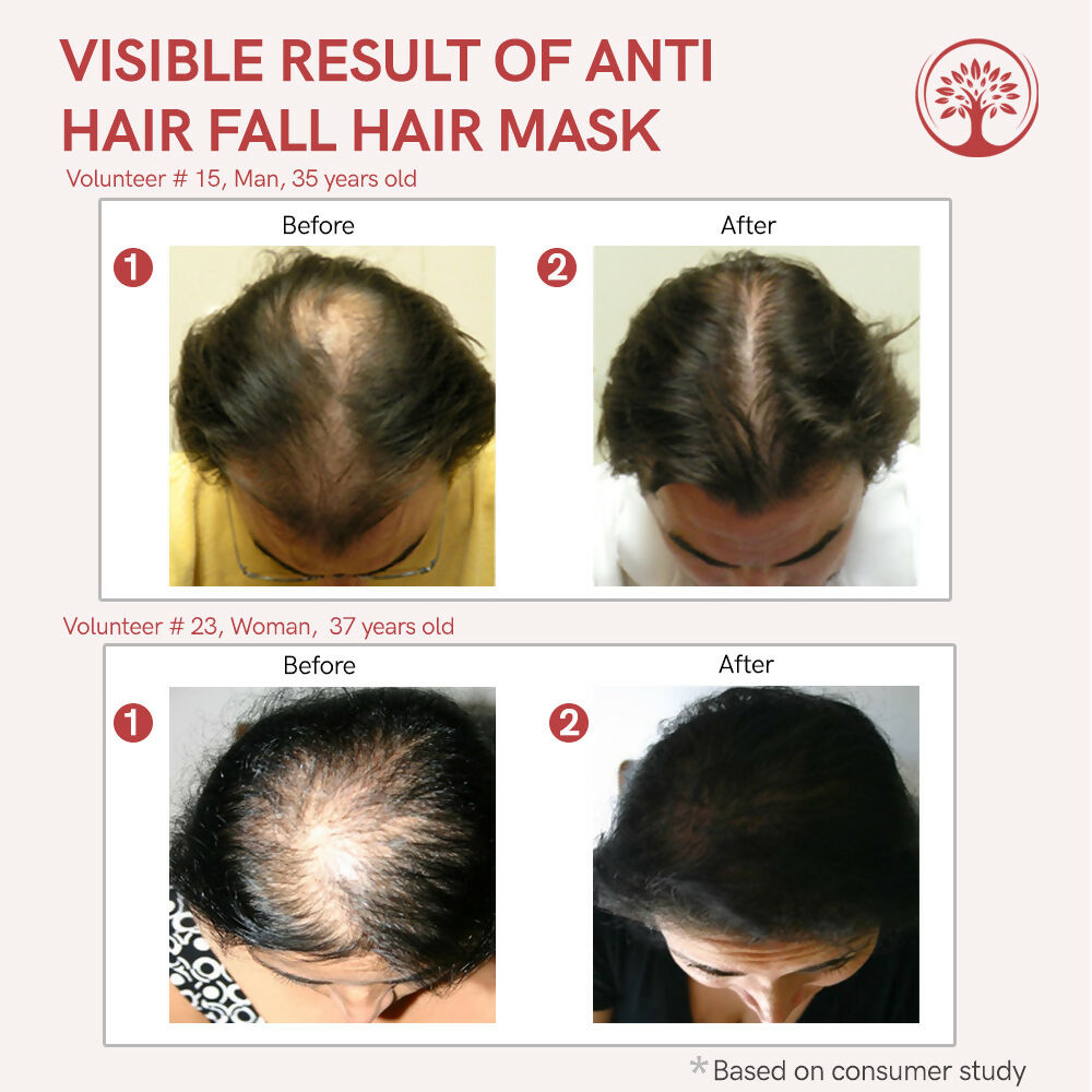 Ivory Natural Hair Fall Hair Mask - Loss Of Hair Control For Both Men & Women - Distacart