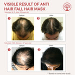 Thumbnail for Ivory Natural Hair Fall Hair Mask - Loss Of Hair Control For Both Men & Women - Distacart