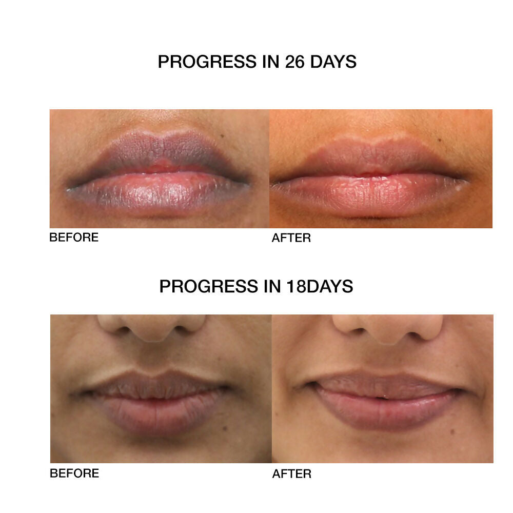 Skog Lip Repair Oil