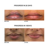 Thumbnail for Skog Lip Repair Oil