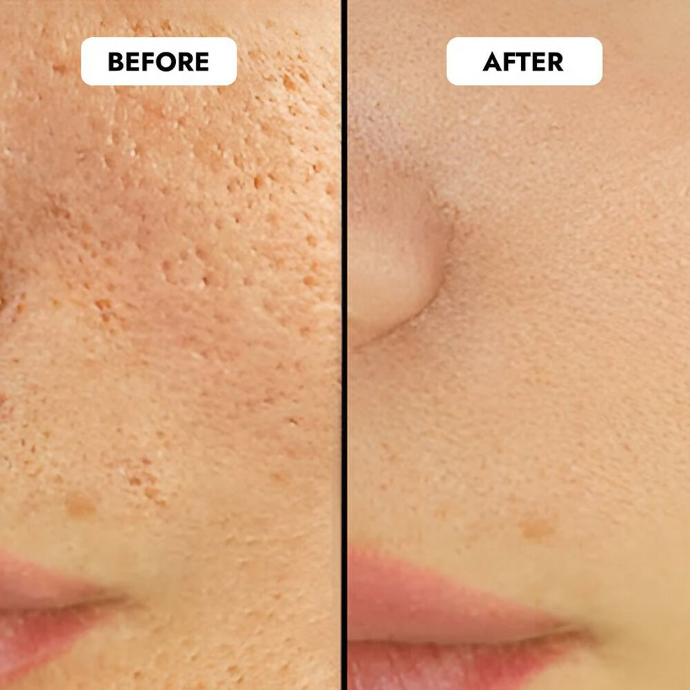 Cos-IQ Niacinamide Vitamin B3-5% Face Serum for Ultra Sensitive Skin