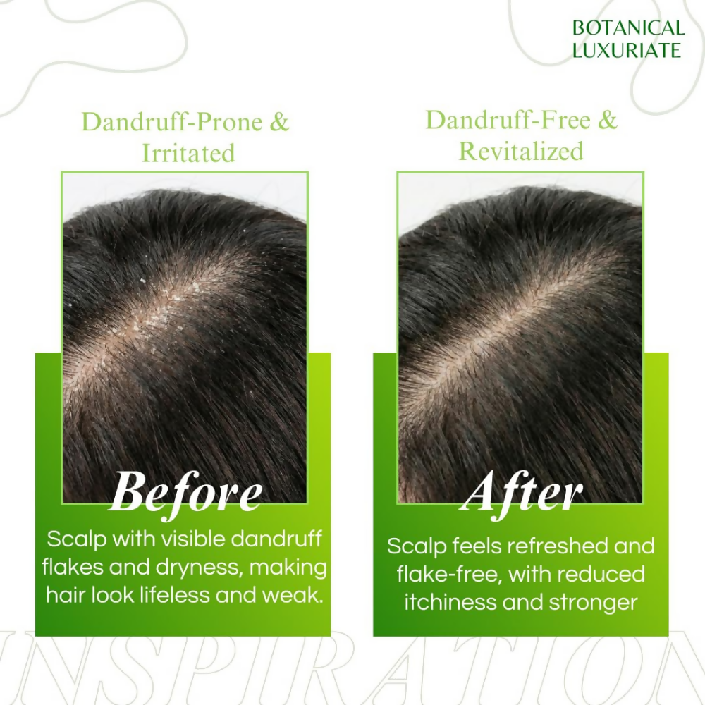 Botanical Luxuriate Amla & Rosemary Anti-Dandruff Shampoo - Dista