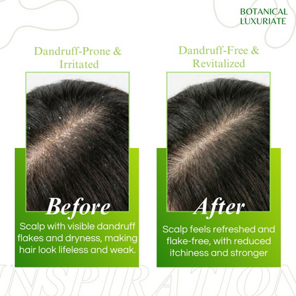 Botanical Luxuriate Amla & Rosemary Anti-Dandruff Shampoo - Dista