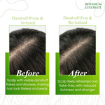 Thumbnail for Botanical Luxuriate Amla & Rosemary Anti-Dandruff Shampoo - Dista
