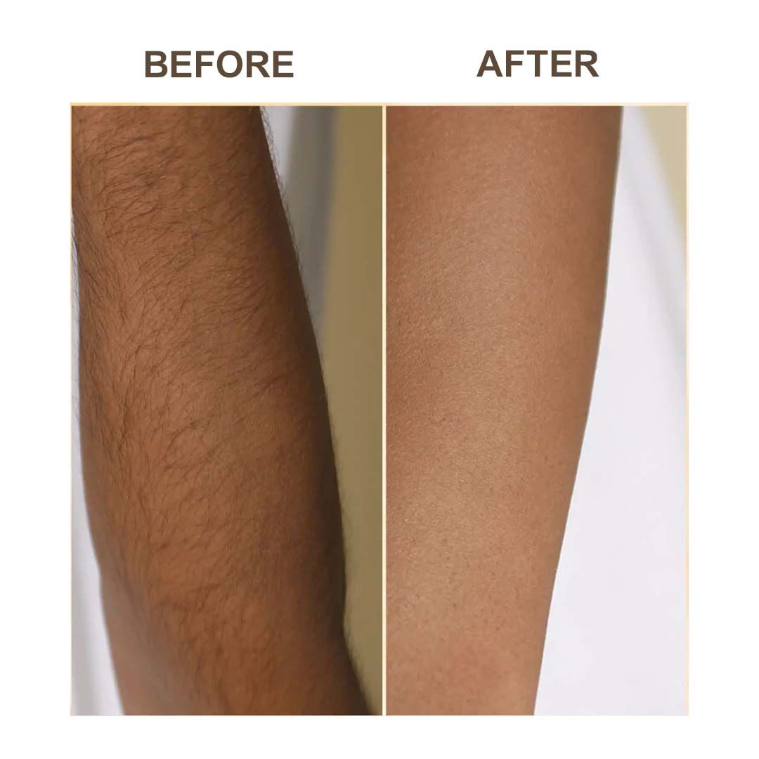 Samisha Haldi Hair Removal Powder - Distacart