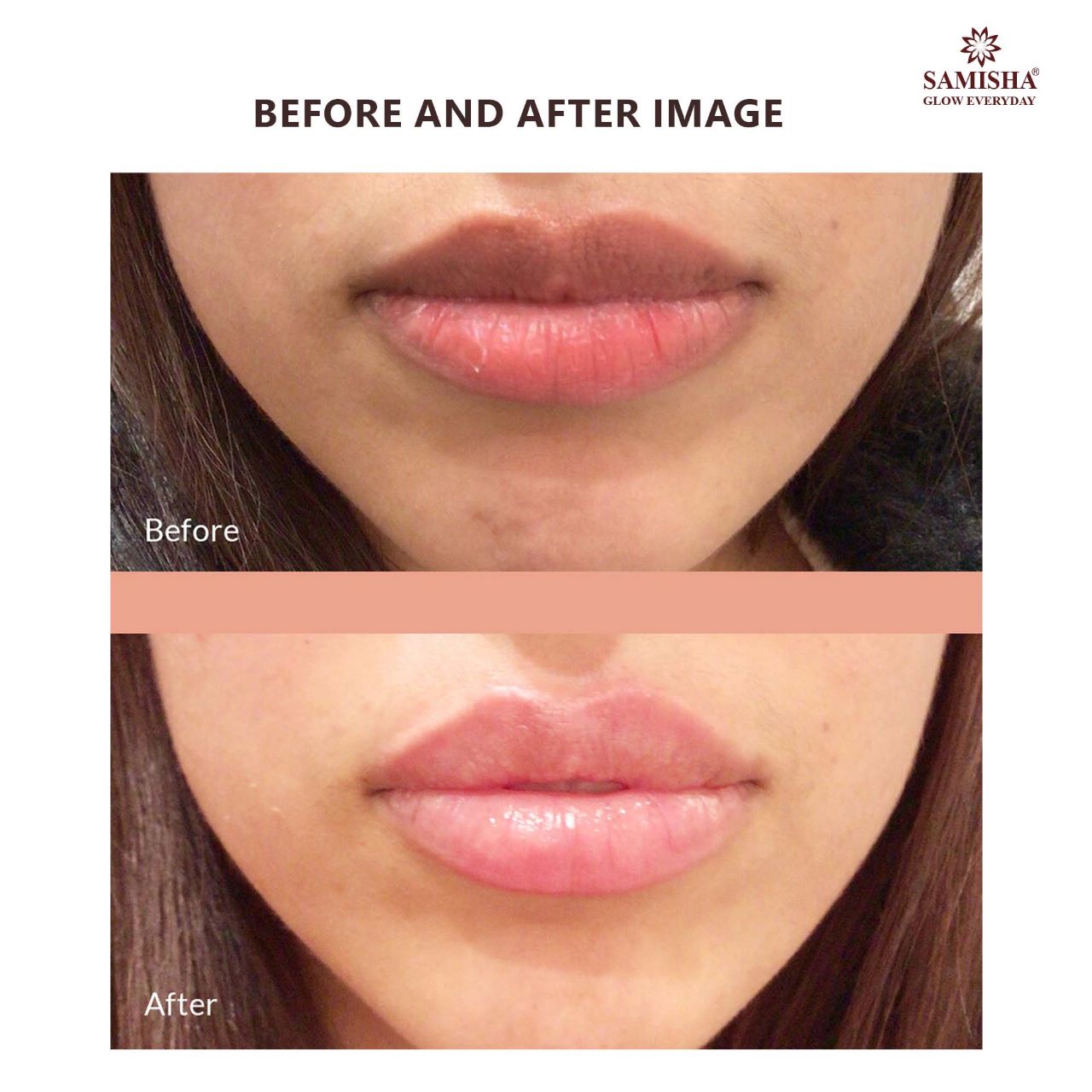 Samisha Beetroot Lip Lightening Scrub - Distacart