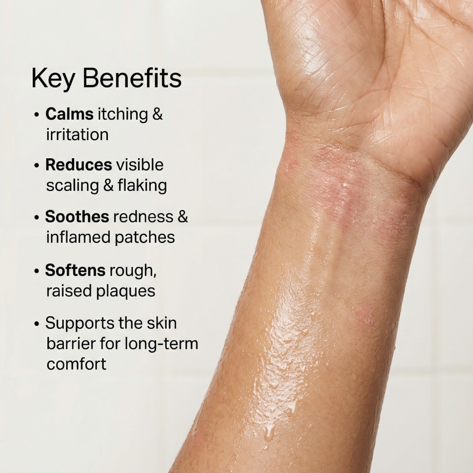 Vedicderm Psoriasis Cream - Distacart