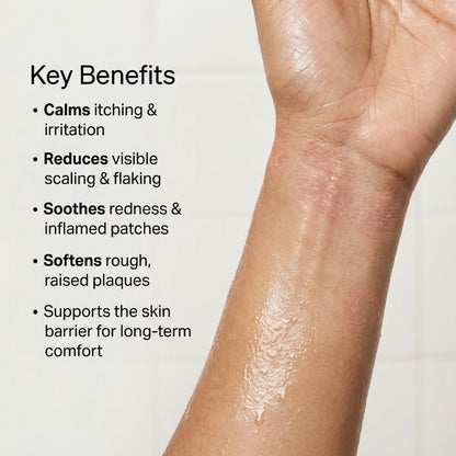 Vedicderm Psoriasis Cream - Distacart
