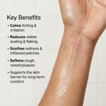Thumbnail for Vedicderm Psoriasis Cream - Distacart