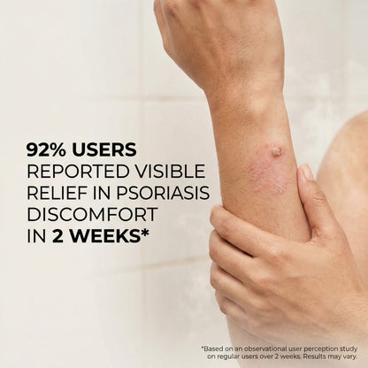 Vedicderm Psoriasis Cream - Distacart