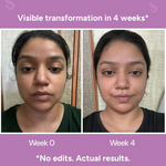 Thumbnail for Citta Anti-Aging Face Serum – Regenerative Serum - Distacart