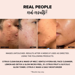 Thumbnail for Nudestix Nudeskin Gentle Hydra-Gel Face Cleanser - Distacart