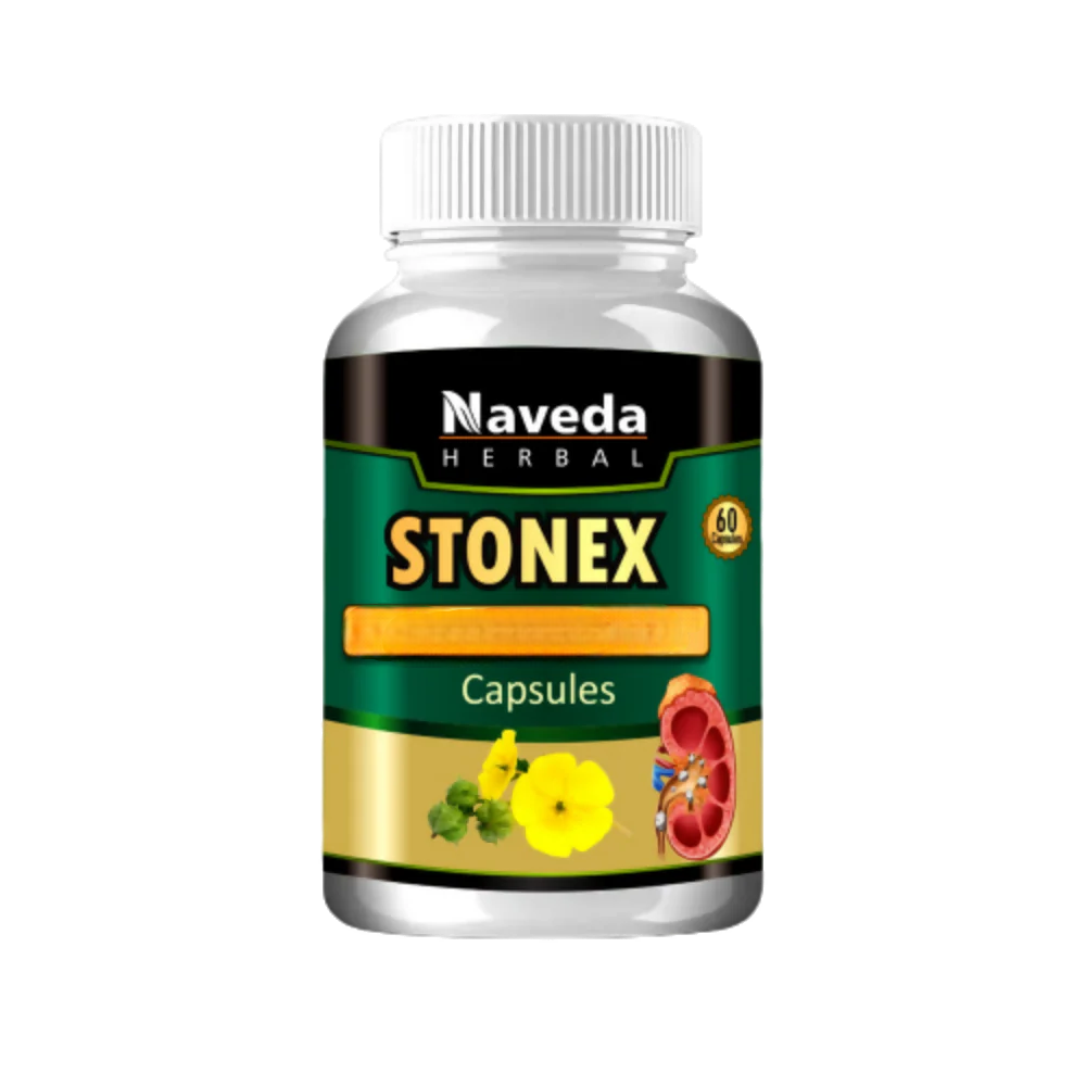 Naveda Herbal Stonex Capsules - Distacart