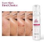 Thumbnail for Alite Anti Acne 5-in-1 Foaming Face Wash with 4% Glycolic Acid & 1% Salicylic Acid - Distacart