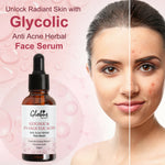 Thumbnail for Globus Remedies Glycolic & 1% Salicylic Acid Anti Acne Face Serum