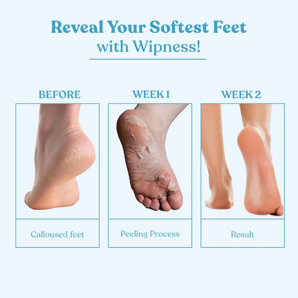 Wipness Natural Foot Peeling & Exfoliating Foot Mask - Dista