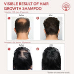 Thumbnail for Ivory Natural Hair Shampoo For Growth - Hair Wellness & Nourishment For Both Men And Women - Distacart