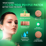 Thumbnail for Urban Yog Acne Pimple Patch - 36 Dots