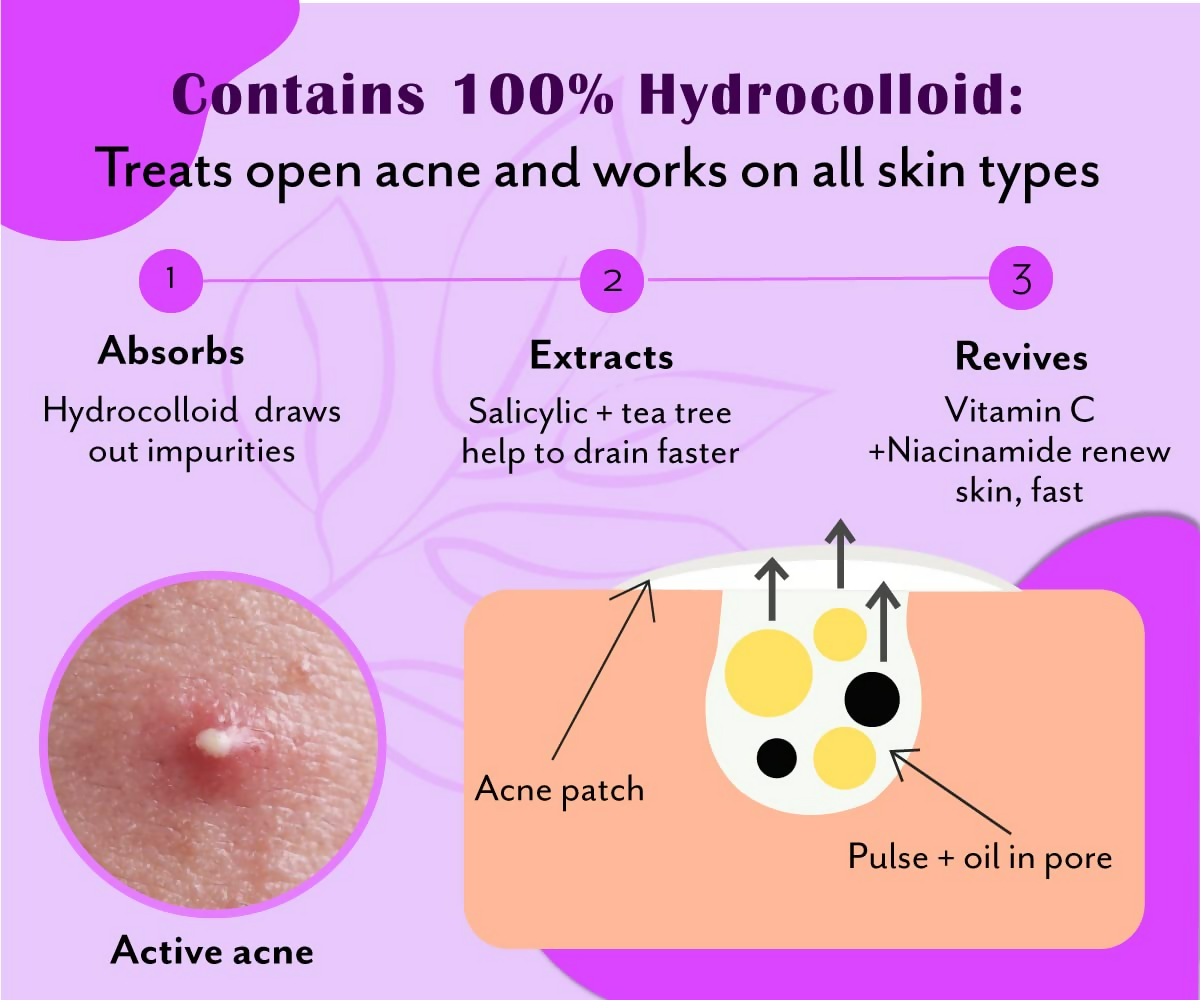 Urban Yog Acne Curvy Pimple Patch - Invisible Facial Stickers cover