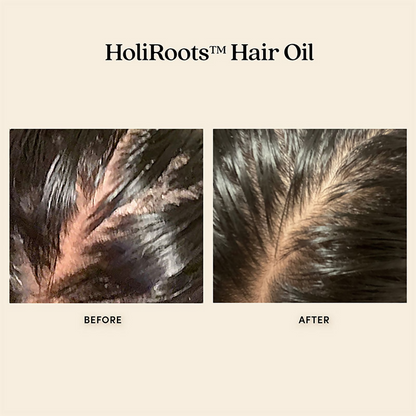 Fable & Mane HoliRoots Oil To Strengthen Roots and Thicken Hair - Distacart