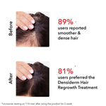Thumbnail for Professional O3+ Women Densiderm Hair Growth Scalp Serum Spray For Anti Hair Loss With Ginseng - Distacart