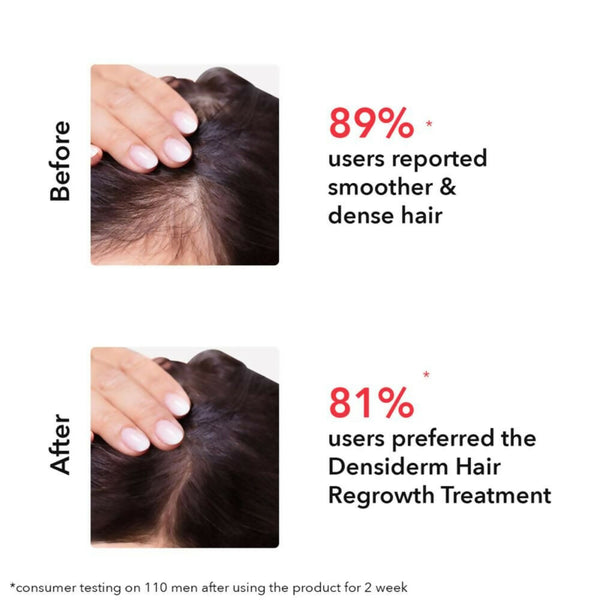 Professional O3+ Women Densiderm Hair Growth Scalp Serum Spray For Anti Hair Loss With Ginseng - Distacart