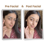 Thumbnail for Alps Goodness Pearl Illuminating Facial Kit with Cucumber - Distacart