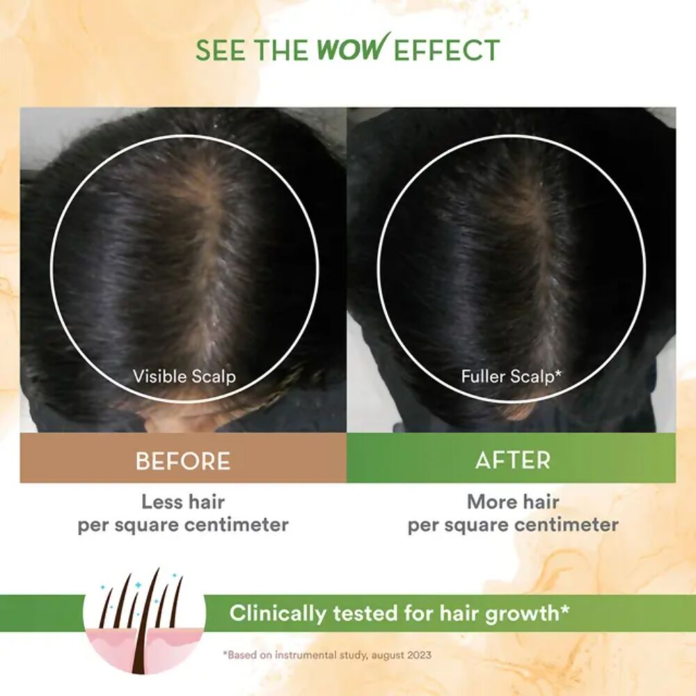 Wow Life Science Rosemary With Biotin Hair Serum - Distacart