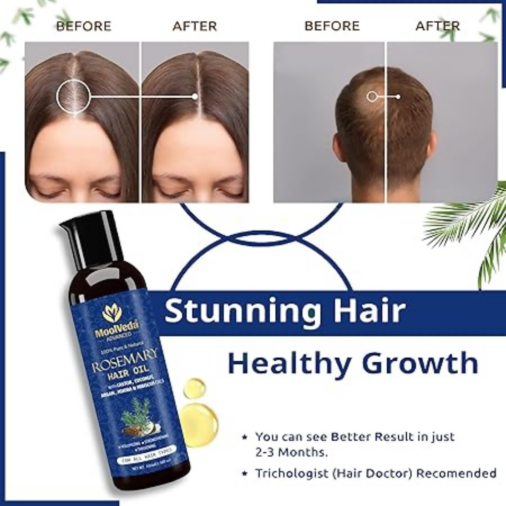 Moolveda 100% Pure Rosemary Hair Oil for Hair Growth - Distacart